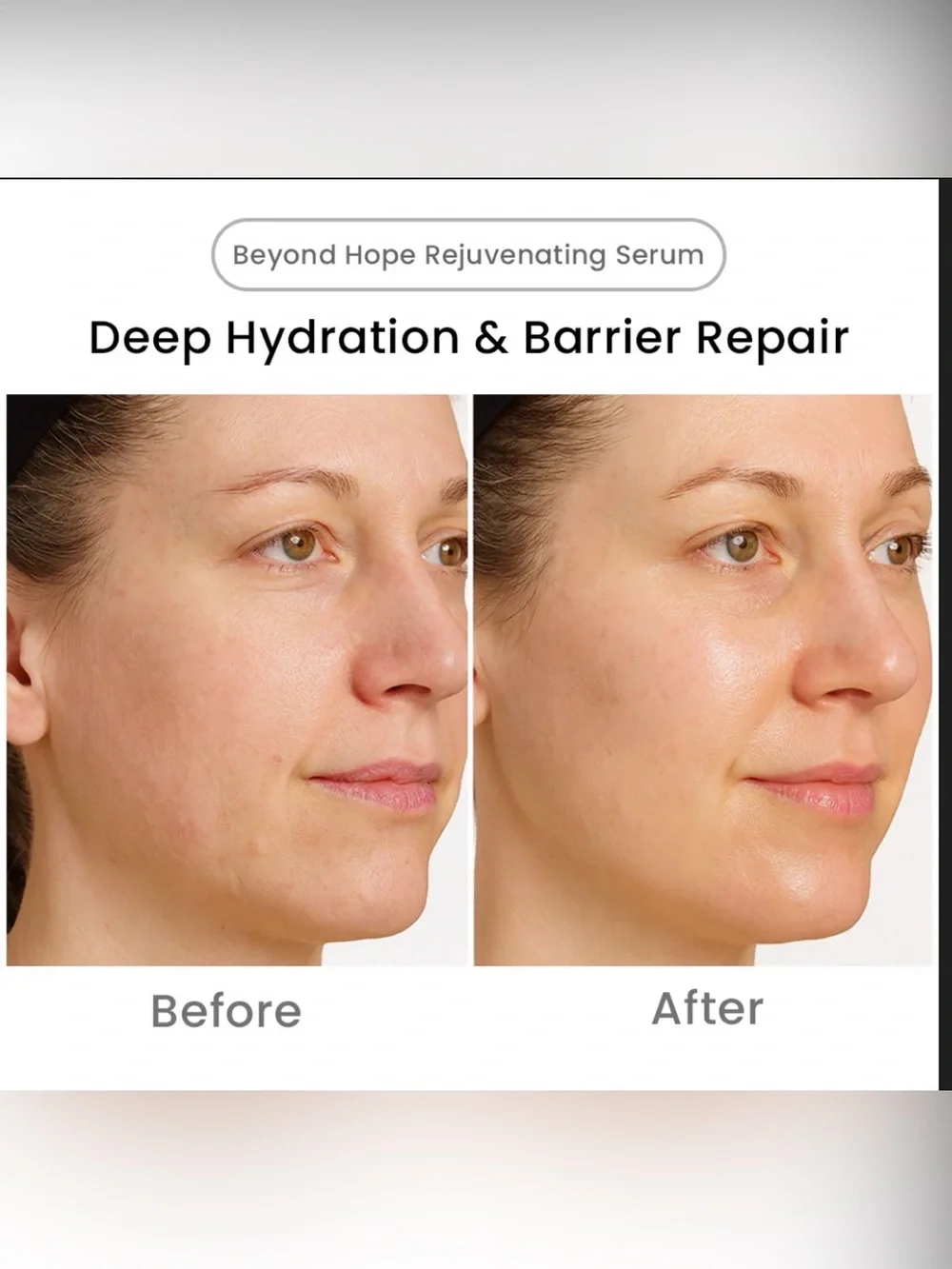 Blaq Beyond Hope Rejuvenating Serum, 10mL / 0.34 fl oz.
